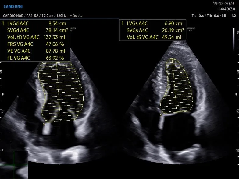 Équipement médical TechCare — Samsung Cv Strain